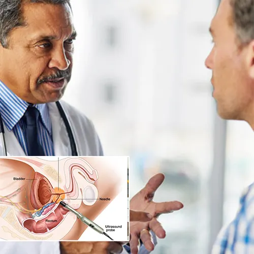 Expert Advice from Brian Steixner


: How to Preserve Your Penile Implant