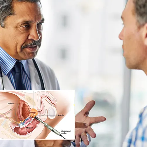 Expert Advice from Brian Steixner: How to Preserve Your Penile Implant