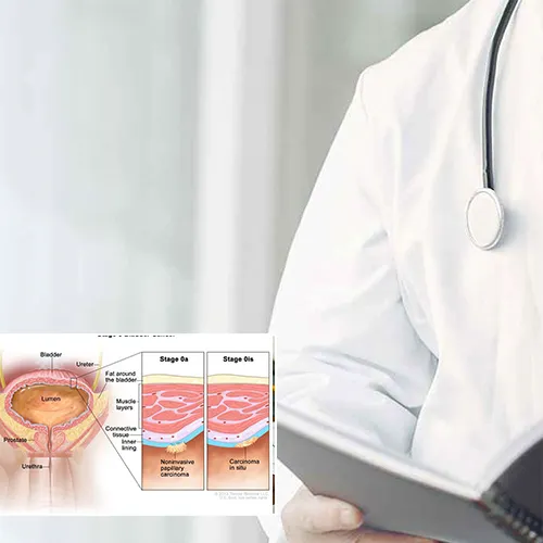 Why Choose   AtlantiCare Physician Group Surgical Associates

for Your Penile Implant Surgery?