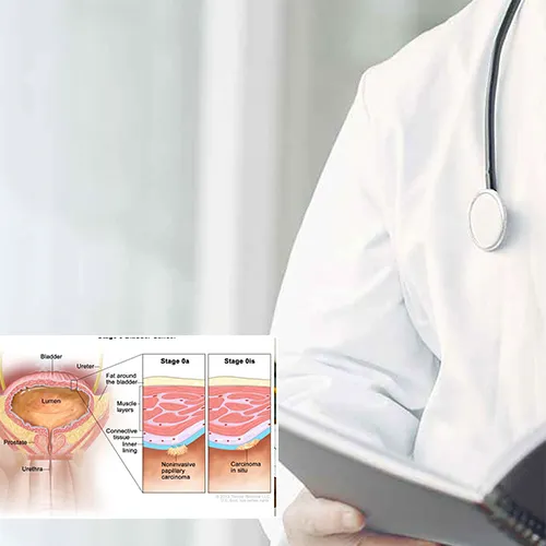 Why Choose   AtlantiCare Physician Group Surgical Associates 
for Your Penile Implant Surgery?